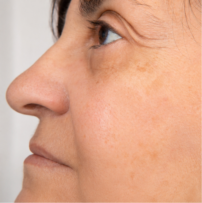 Less Puffiness